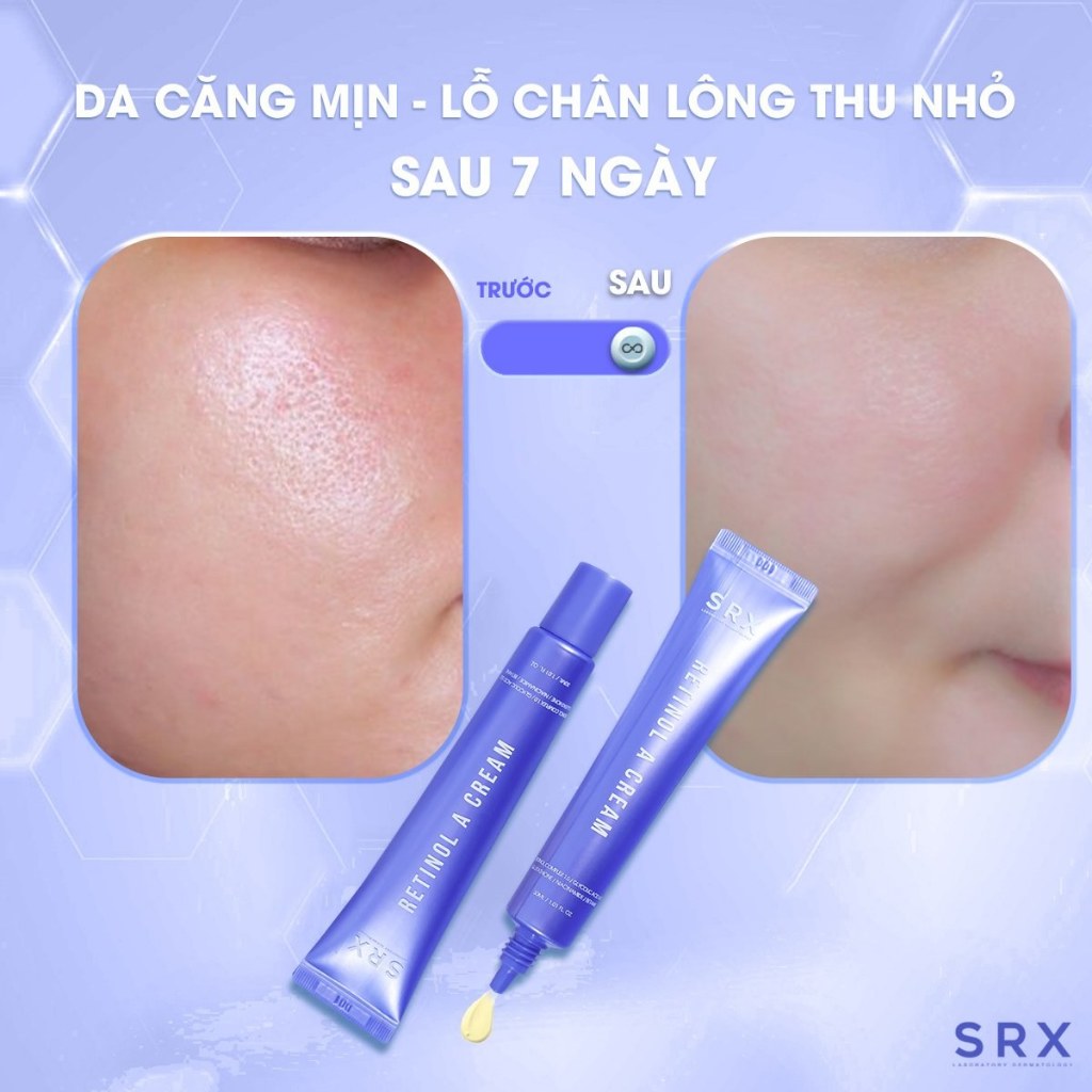 SRX Retinol A Cream - Kem Dưỡng Retinol Complex Trẻ Hóa, Tăng Cường Sau Peel Retinol 30ml.