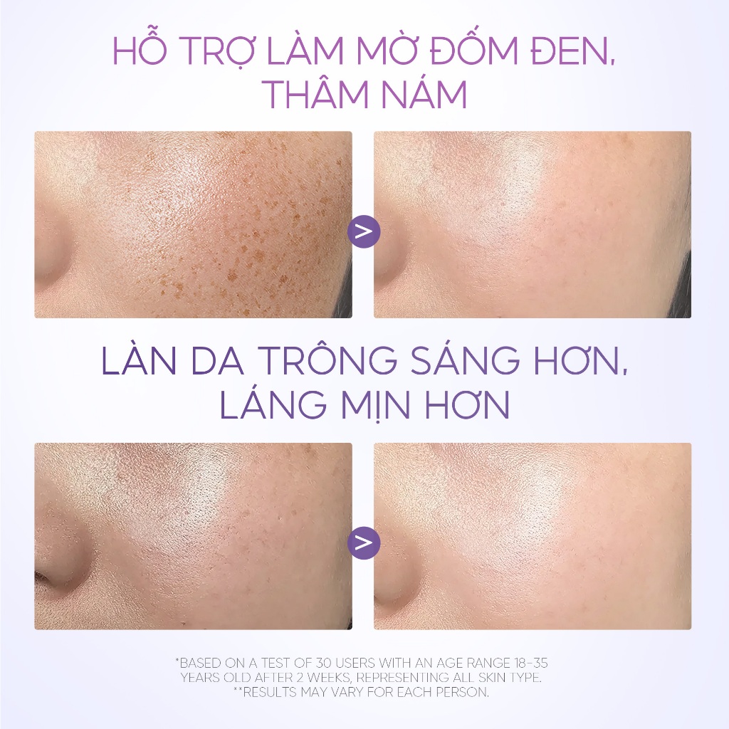 Gel dưỡng ẩm Symwhite 377 làm mờ đốm đen, sáng làn da SKINTIFIC 30g