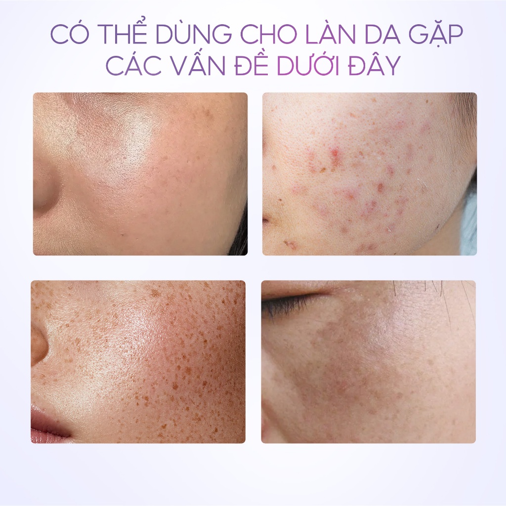 Gel dưỡng ẩm Symwhite 377 làm mờ đốm đen, sáng làn da SKINTIFIC 30g