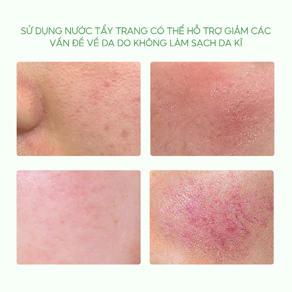 [Sản phẩm mới] Nước tẩy trang ngải cứu thư thái làn da SKINTIFIC 300ml