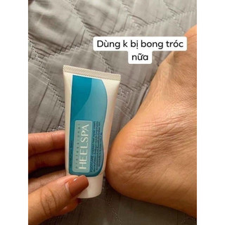 Thuốc thoa trị nứt gót chân Heel Spa