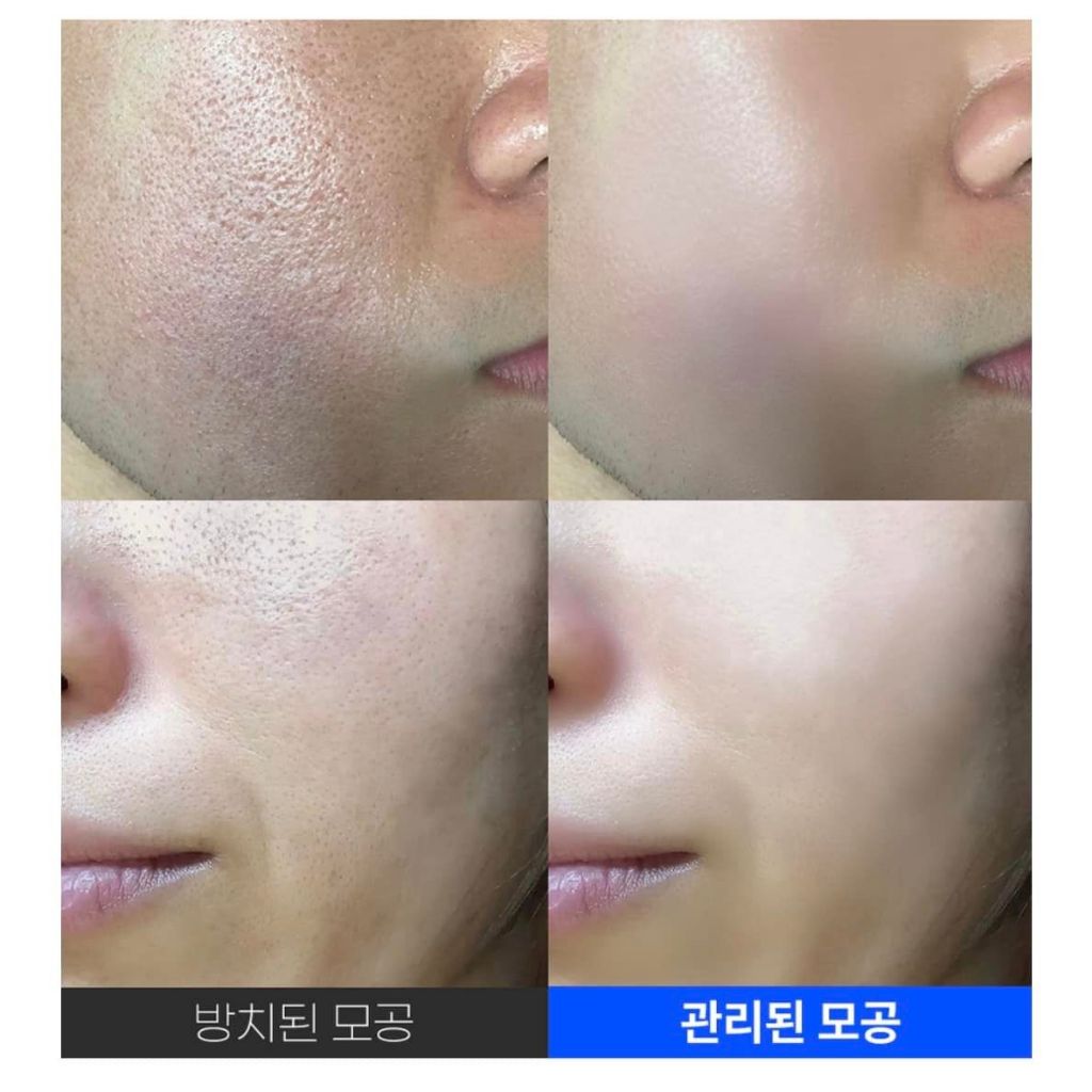 Serum Sungboon Editor Green Tomato Pore Lifting Ampoule+  75ml