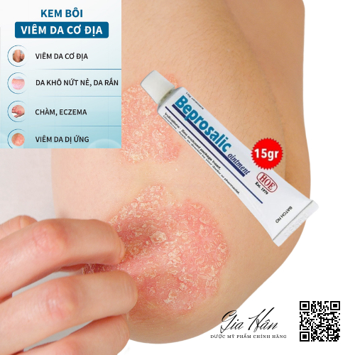 Beprosalic 15g kem bôi giảm Vẩy nến, Chàm, Da tiết bã, Nấm da - Mỹ phẩm chính hãng HOE.