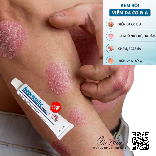 Beprosalic 15g kem bôi giảm Vẩy nến, Chàm, Da tiết bã, Nấm da - Mỹ phẩm chính hãng HOE.