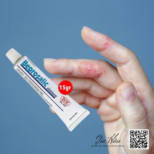 Beprosalic 15g kem bôi giảm Vẩy nến, Chàm, Da tiết bã, Nấm da - Mỹ phẩm chính hãng HOE.