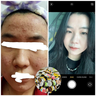 Thảo mộc xanh x5 (𝐂𝐡𝐢́𝐧𝐡 𝐡𝐚̃𝐧𝐠 & 𝐟𝐫𝐞𝐞𝐬𝐡𝐢𝐩)