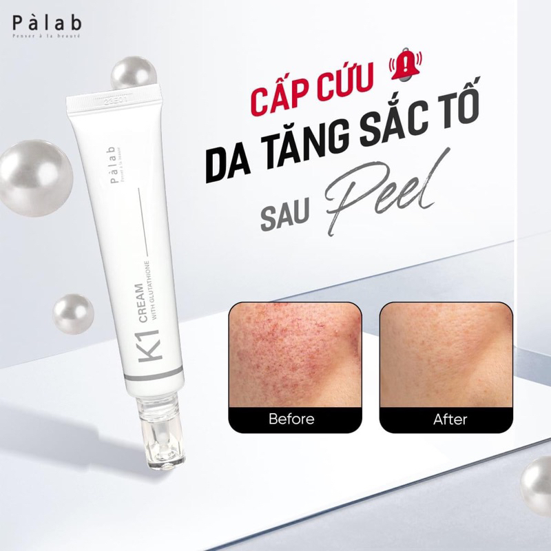 K1 PALAB - Kem dưỡng Vitamin K1 Phục Hồi Da Kích Ứng, Dãn Mạch, Da Sau Xâm Lấn