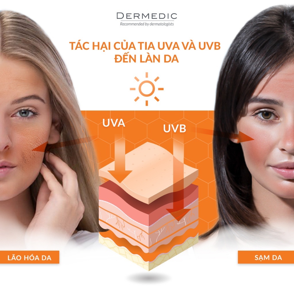 Kem chống nắng dành cho da dầu Dermedic Sunbrella Sun Protection Cream Oily and Combination Skin SPF 50+ (50g)