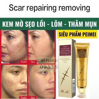 Kem mờ sẹo mờ thâm - kem giảm sẹo và rạn da - chống sẹo lồi sẹo lõm hiệu quả sau 1 tuần