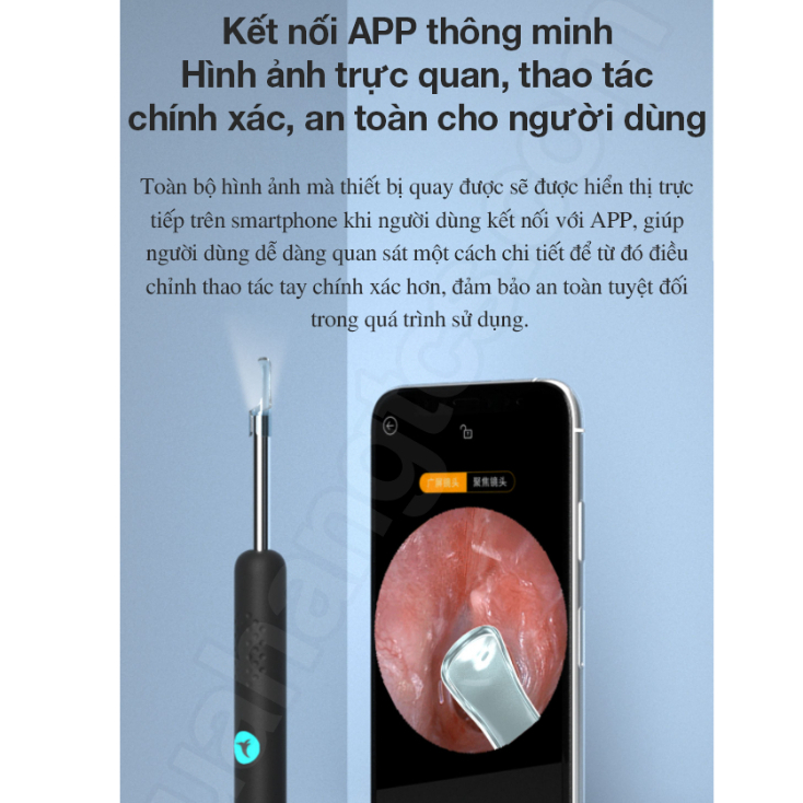 Dụng cụ lấy ráy tai Xiaomi Bebird R1