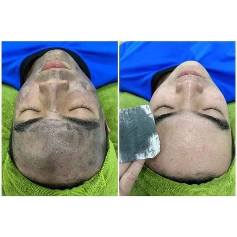 Viên hút chì thải độc tố Haosani 100 viên giá sỉ thùng 13x