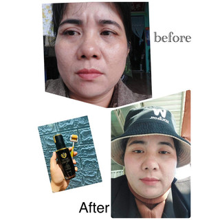Tinh chất sâm đất drcell hổ trợ giảm mụn thâm - 50ml