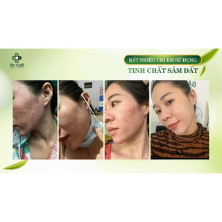 Tinh chất sâm đất drcell hổ trợ giảm mụn thâm - 50ml