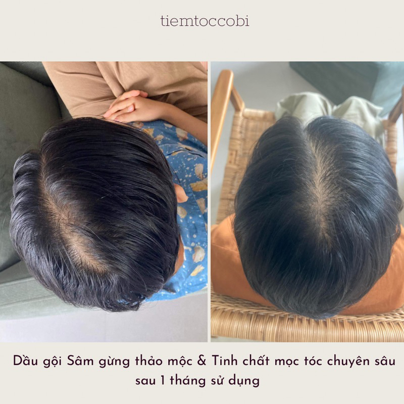 COMBO CHĂM SÓC TÓC