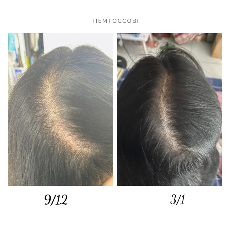 COMBO CHĂM SÓC TÓC