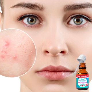 Serum Chấm Mụn Siêu Tốc Propeller Boltushka 25ml