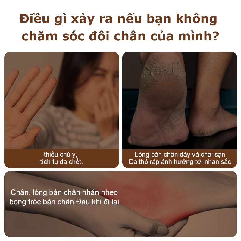 Máy Tẩy Tế Bào Chết Gót Chân UPUPIN C8-02, Tẩy Tế Bào Chết Mini, Dễ Dàng Loại Bỏ Da Chết