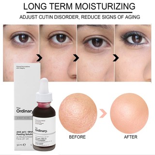 Tinh Chất Peel da The Ordinary AHA 30%+BHA 2% Peeling Solution 30ml