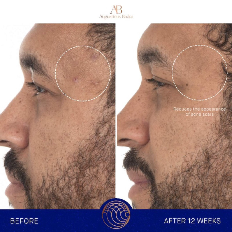 Serum chống lão hoá cao cấp Augustinus Bader The Retinol Serum