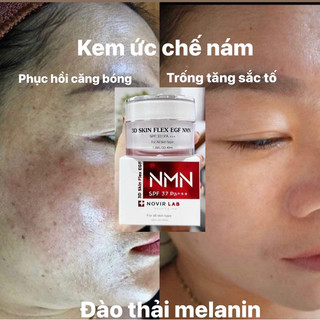 Kem ức chế nám MNM novir lab