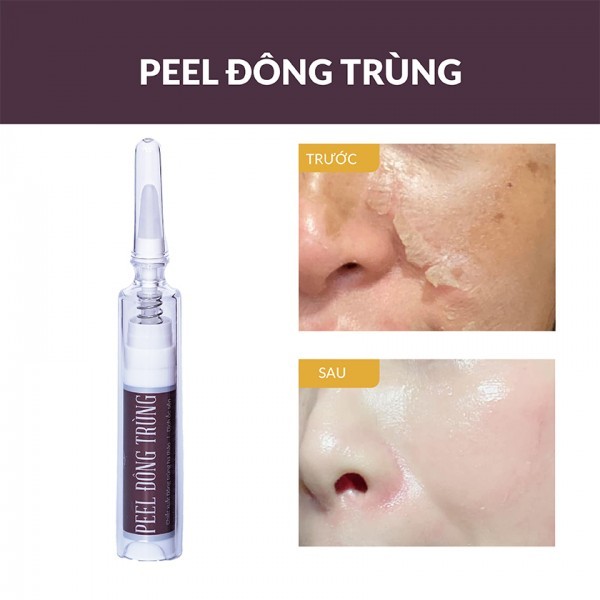 Peel Da Đông Trùng Tươi HUYỀN PHI Bóc Tách Nám Dưỡng Da Trắng Hồng Căng Bóng Mịn Màng