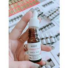 Serum trị mụn trắng da Honesi  1chai