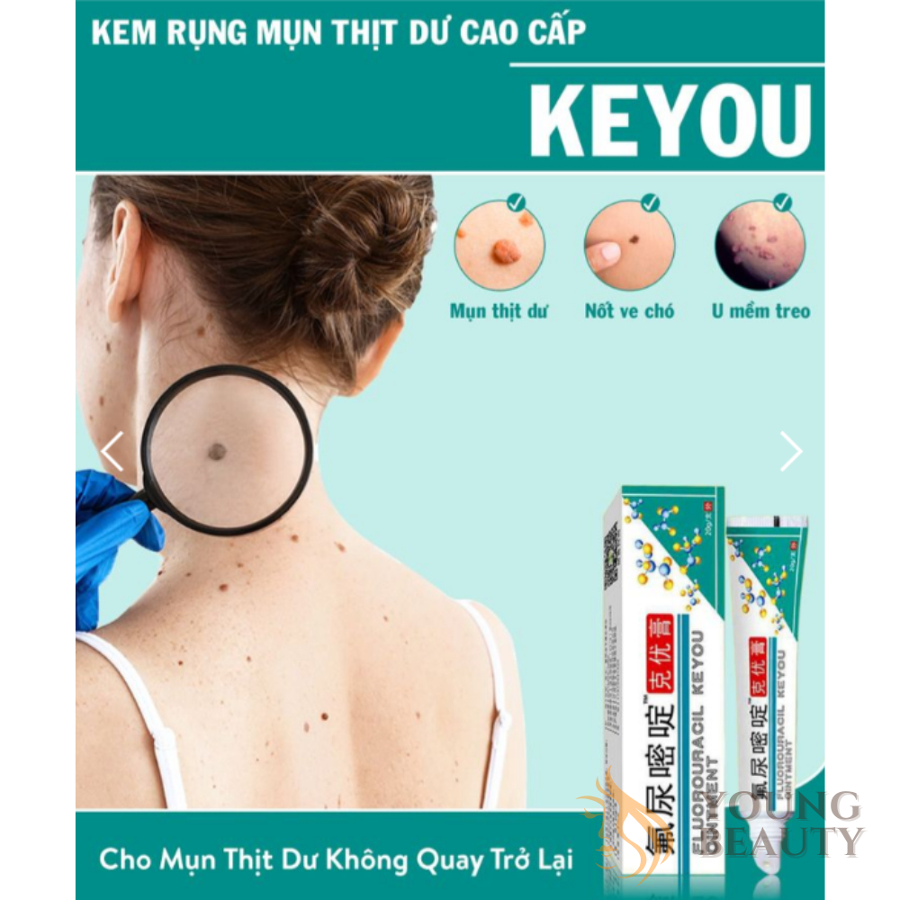 Kem giảm mụn thịt KEYOU, Kem bôi KEYOU, Giảm chai sần, mụn cóc, Không còn gốc tái đi tái lại - YOUNG BEAUTY