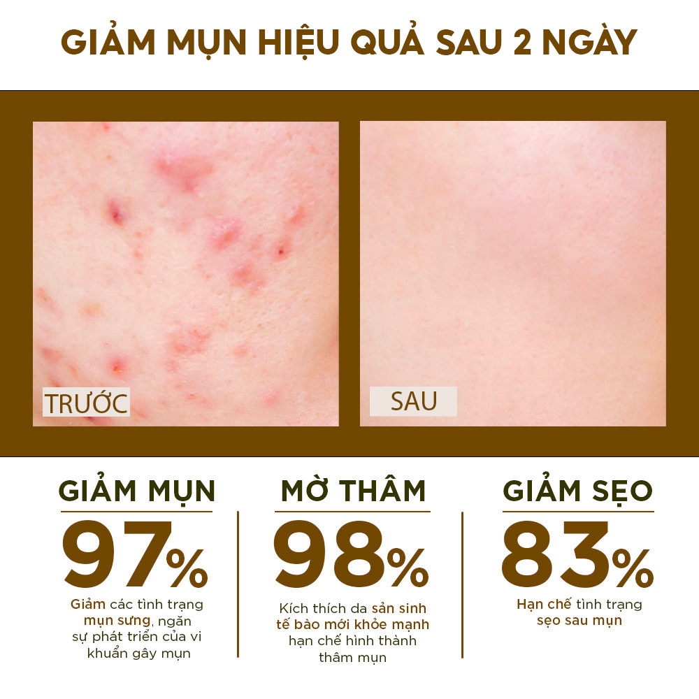 Kem mụn Mù U - Tamanu Cream, Olong Tonner Dr.Luvis giảm mụn, cấp ẩm cho da