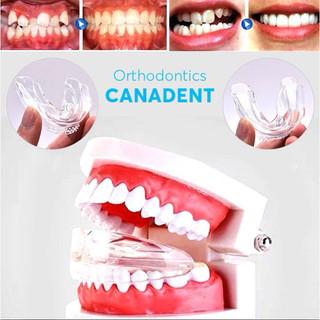 (NIỀNG RĂNG) BỘ 3 NIỀNG RĂNG SILICON CANADENT ALIGNMENT.