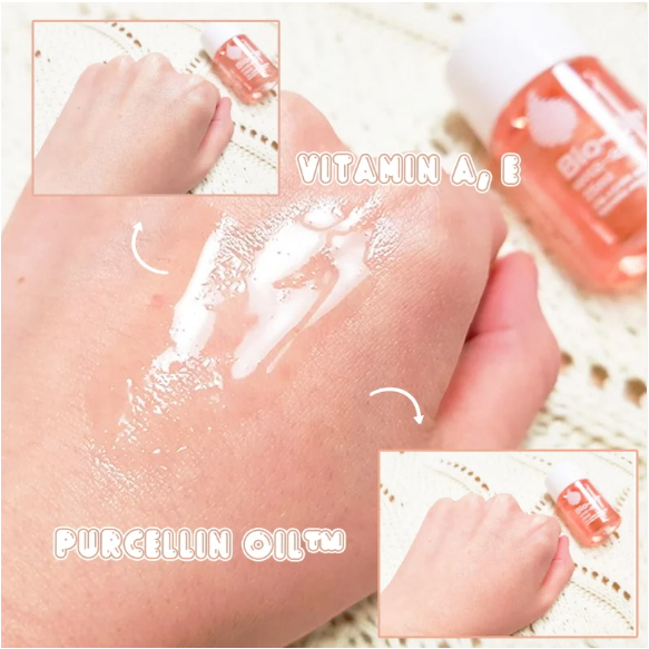 Dầu Chăm Sóc Da BIO-OIL Giúp Mờ Sẹo và Giảm Rạn Da
