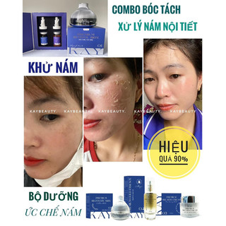 COMBO TRI NAM KAY BEAUTY ( kem peel + tách nám )