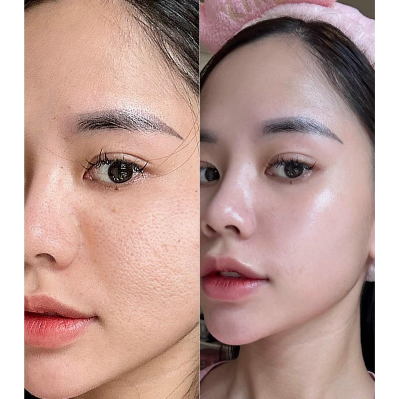 Kem dưỡng Retinal bakuchiol A-mazing night cream, tái tạo trẻ hóa xoá nhăn đều màu da