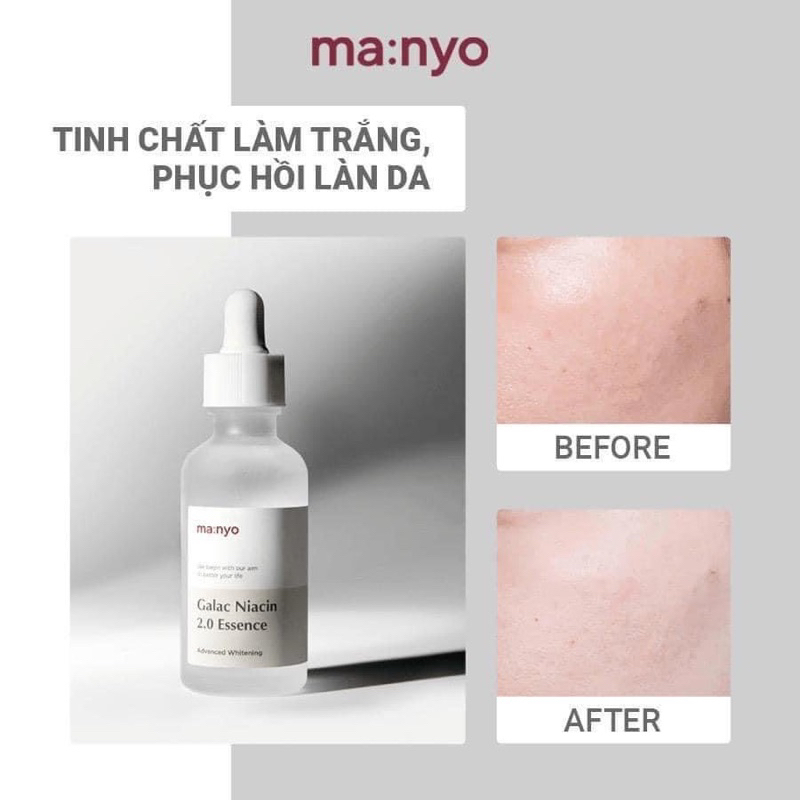 𝐓𝐢𝐧𝐡 𝐂𝐡𝐚̂́𝐭 𝐃𝐮̛𝐨̛̃𝐧𝐠 𝐓𝐫𝐚̆́𝐧𝐠 𝐌𝐚𝐧𝐲𝐨 𝐆𝐚𝐥𝐚𝐜 𝐍𝐢𝐚𝐜𝐢𝐧 𝟐.𝟎 𝐄𝐬𝐬𝐞𝐧𝐜𝐞 30ml