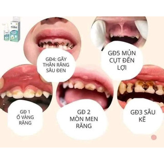 Xịt chống sâu răng Midkid