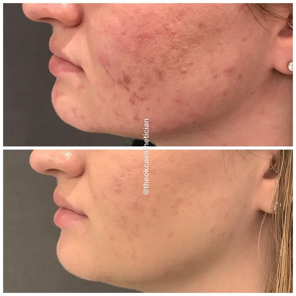 Kem chống lão hóa nâng cơ mặt  Zo Skin Health Wrinkle + Texture Repair lọ 50ml