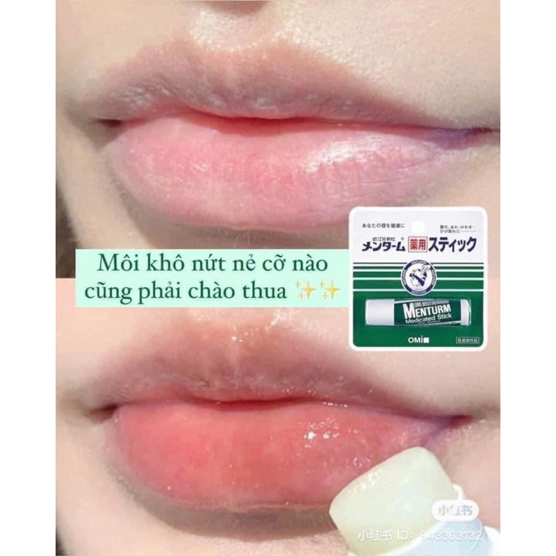 Son dưỡng môi OMI Menturm Nhật bản