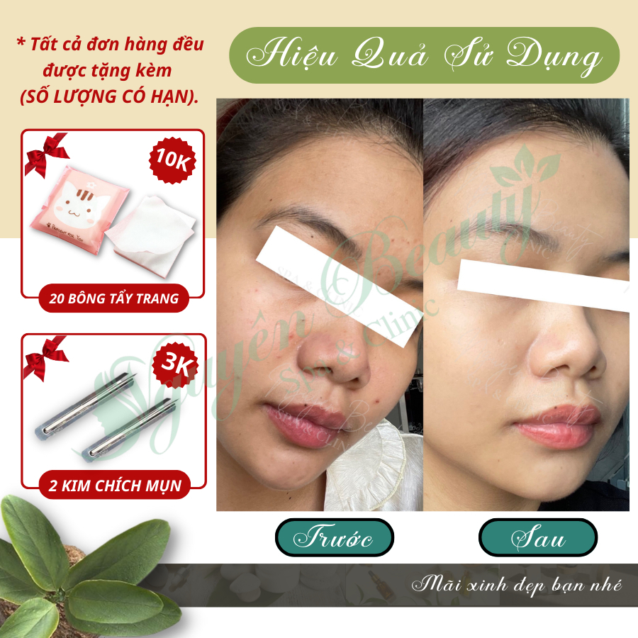 Kem ngăn ngừa lão hóa, dưỡng trắng và tái tạo da 0.5%, 1.0% Retinol Skin Brightener Zo Skin Health