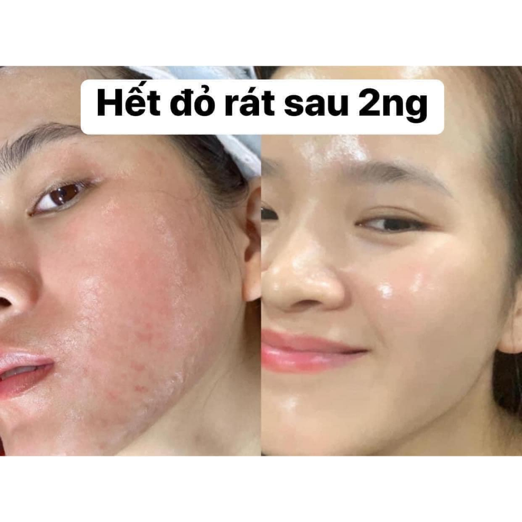 Kem Dưỡng Innoaesthetics Inno-Derma Skin Repair Sửa Chữa, Phục Hồi Da Khẩn Cấp 60gr