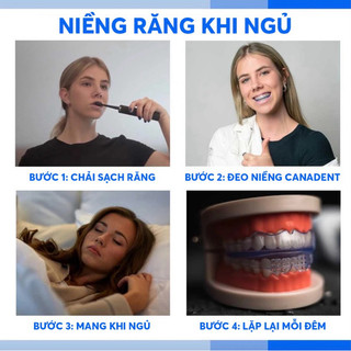 (NIỀNG RĂNG) BỘ 3 NIỀNG RĂNG SILICON CANADENT ALIGNMENT.