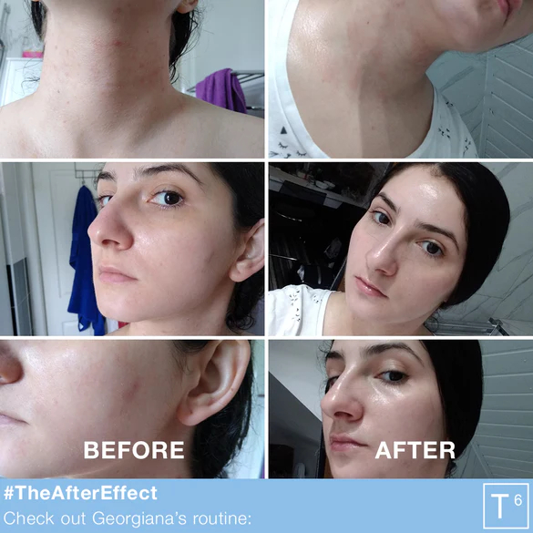 Tẩy tế bào chết ''Facetheory'' Saliatica 2% BHA Exfoliant T6 200ml