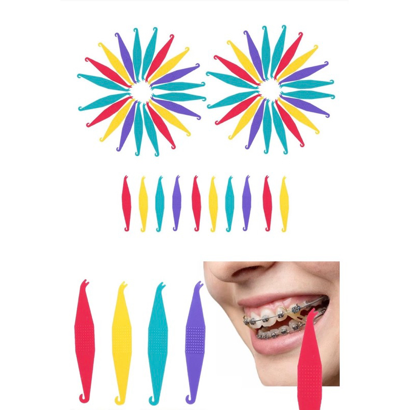 Cây móc chun kéo liên hàm