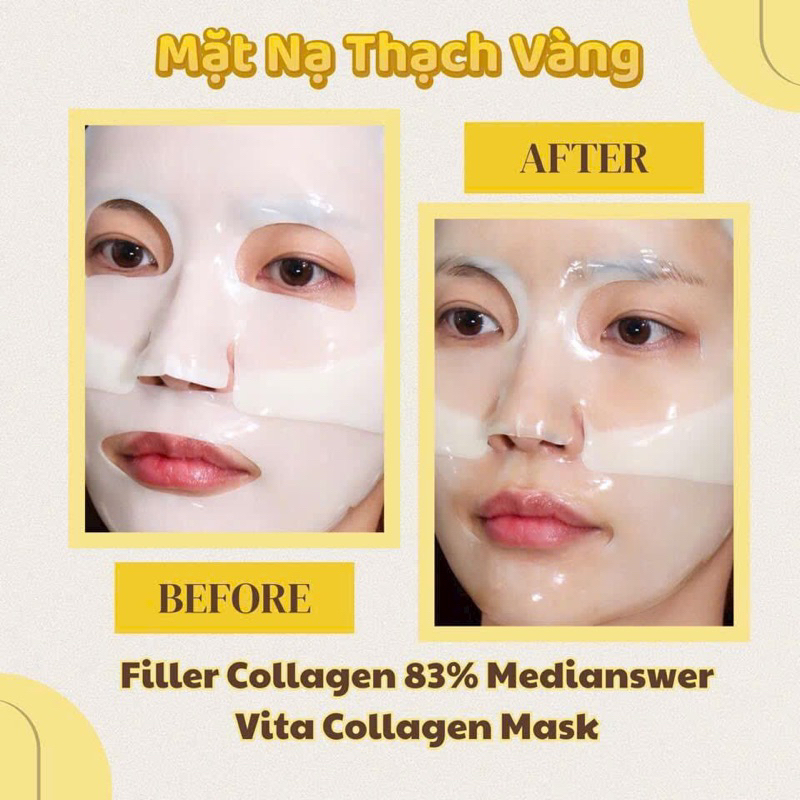 Mặt Nạ Thạch Collagen MediAnswer Vita Collagen Mask Chống Lão Hóa Và Chăm Sóc Toàn Diện