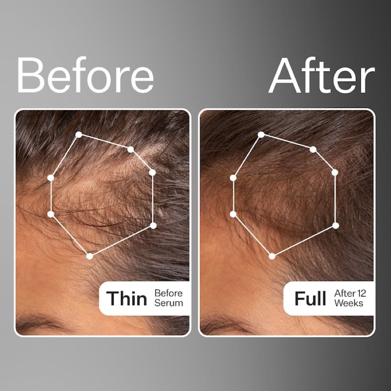 Tinh chất dưỡng da đầu Act + Acre 2% Stem Cell H2-Grow Complex Scalp Serum for Hair Growth