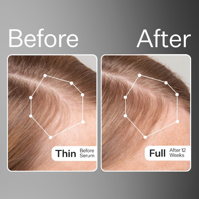 Tinh chất dưỡng da đầu Act + Acre 2% Stem Cell H2-Grow Complex Scalp Serum for Hair Growth
