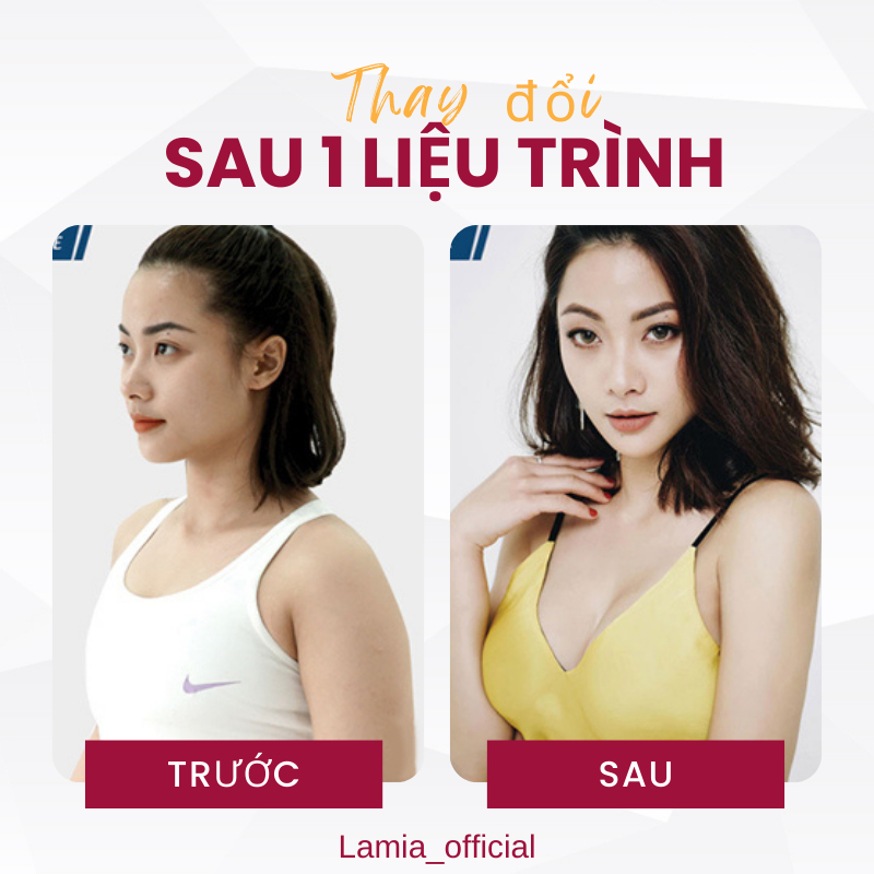 Viên nở ngực LADY PLUS GOLD  tăng vòng 1 hồng nhũ hoa hiệu quả an toàn hộp 20 viên