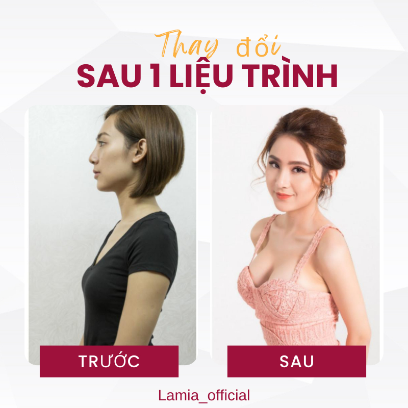 Viên nở ngực LADY PLUS GOLD  tăng vòng 1 hồng nhũ hoa hiệu quả an toàn hộp 20 viên