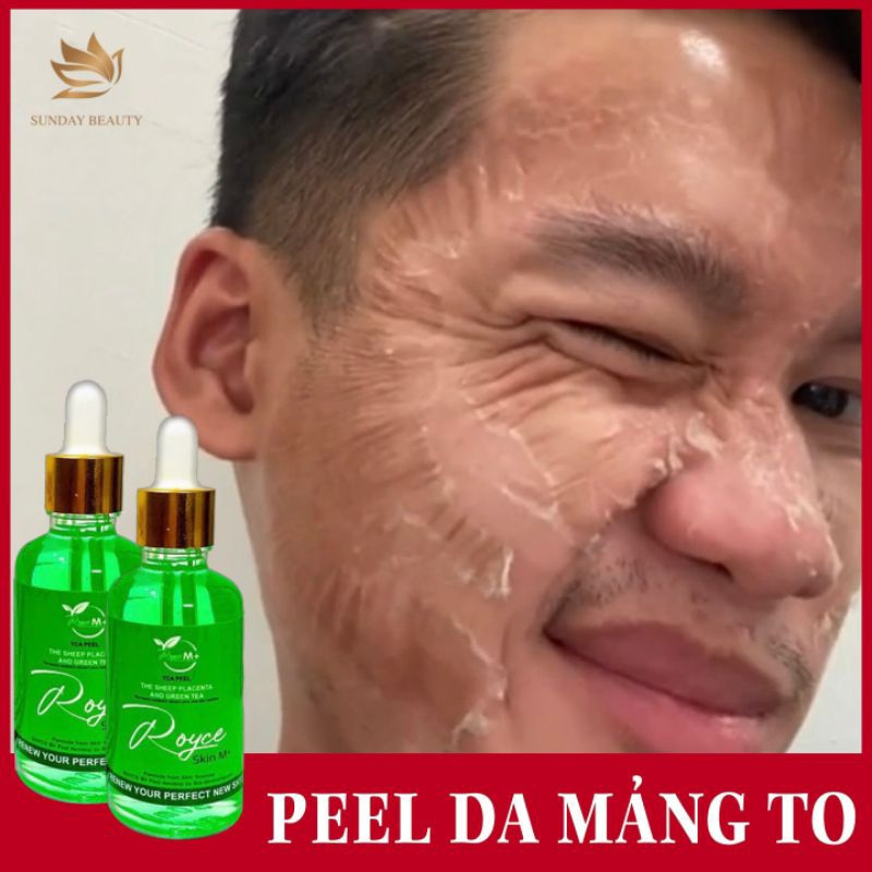 Peel da ROYCE SKIN M+ da bong mảng to bóc tách sẹo rỗ lom nám tàn nhang mụn thâm m0 .