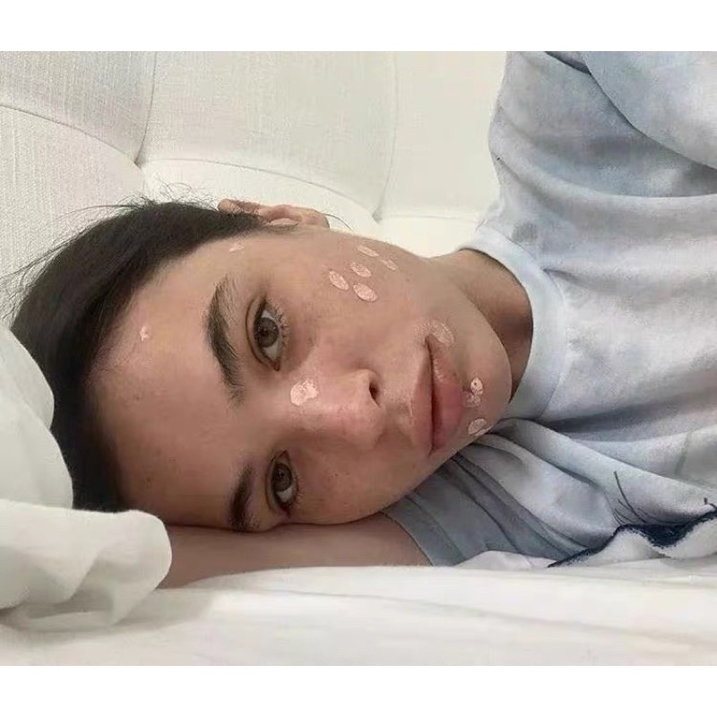 Chấm mụn Kate Sommerville Eradikate Acne Spot Treatment 30ml