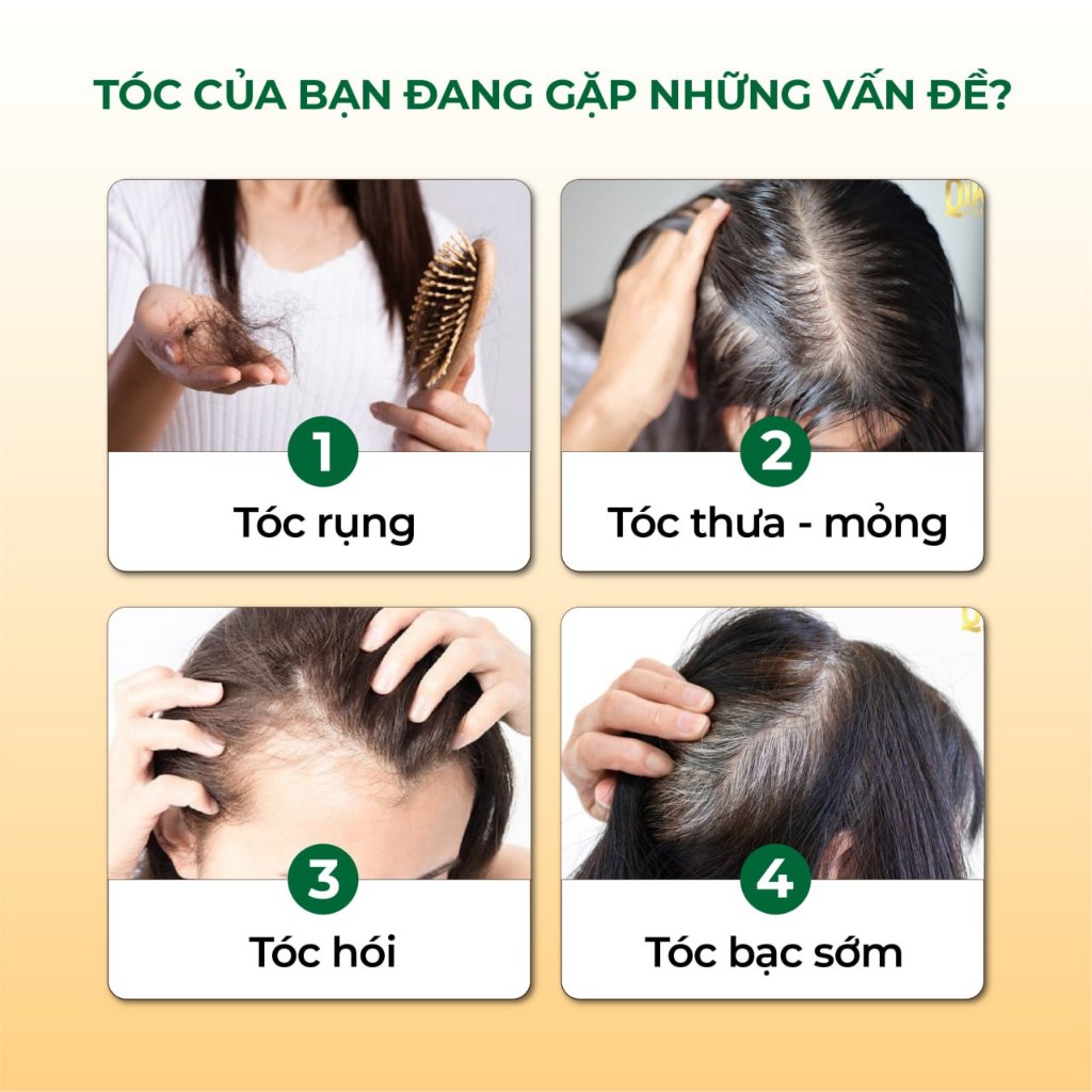 Dầu Gội Xả 2in1 Hà Thủ Ô Cỏ Cây Hoa Lá VIETNAM - Dưỡng tóc đen mượt, bóng khỏe, Kích thích mọc tóc, Dung tích 420g/chai