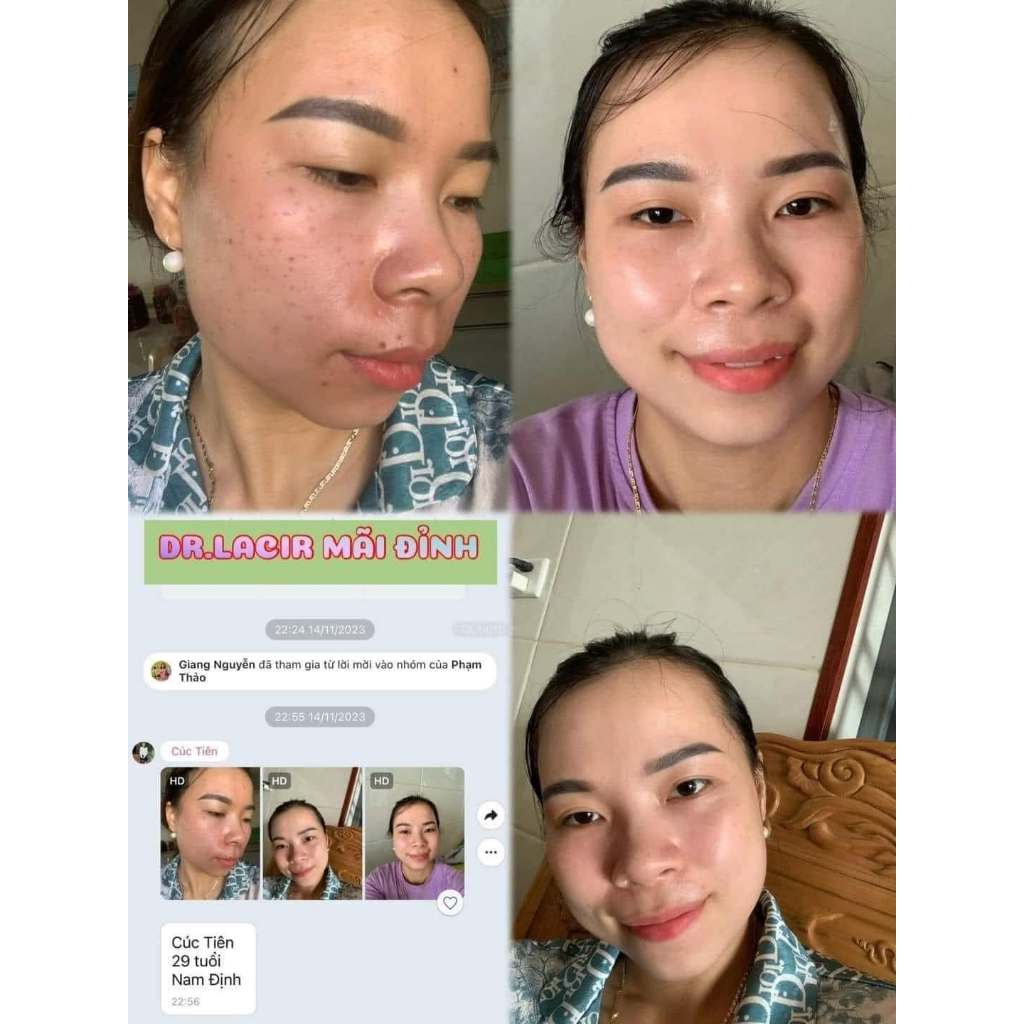 Kem dưỡng căng bóng da Perfect Retinol Rejuvenating Cream VI Collagen Dr Lacir Ylabcos chính hãng